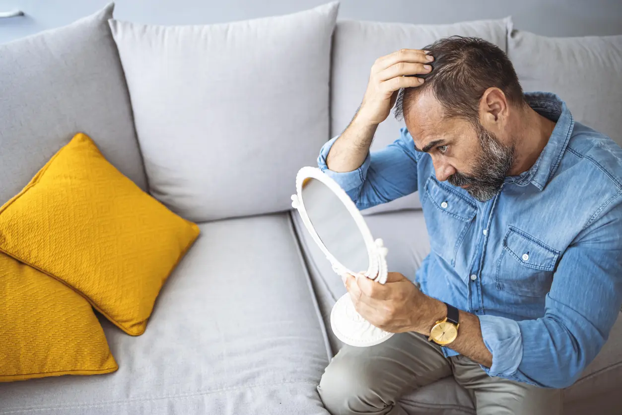 upset-middle-aged-man-with-alopecia-looking-at-mirror